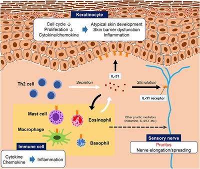 Interleukin-31 as a Clinical Target for Pruritus Treatment